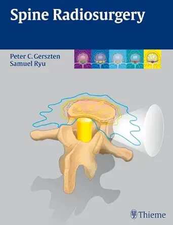 Spine Radiosurgery