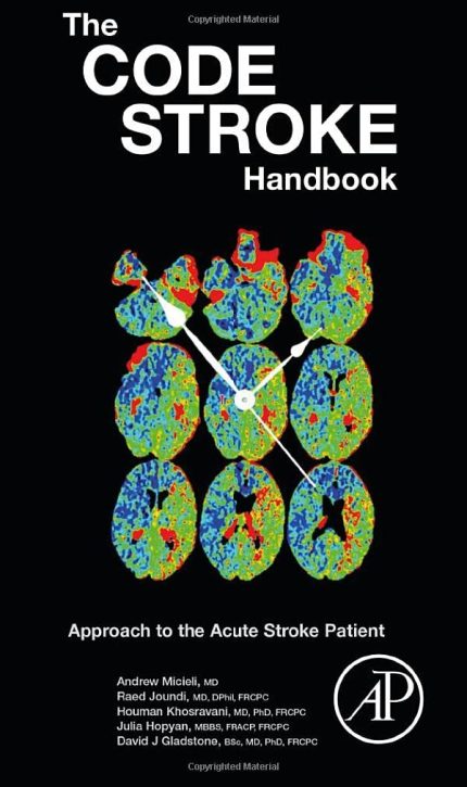 The Code Stroke Handbook: Approach to the Acute Stroke Patient (Digital Download) • D