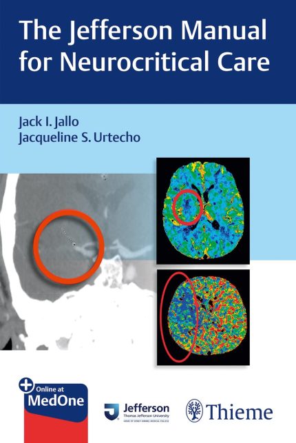 The Jefferson Manual for Neurocritical Care (Digital Download) • E