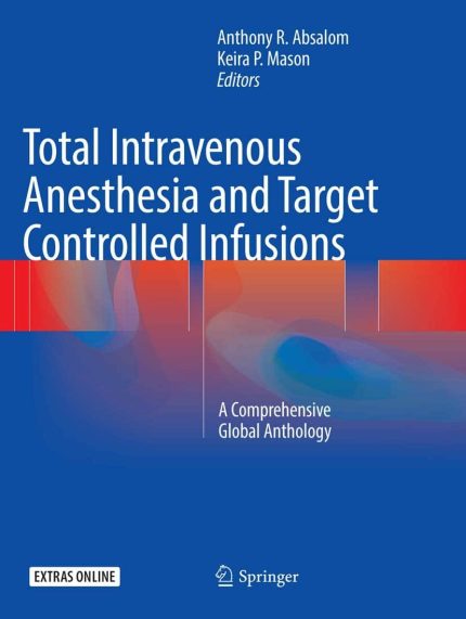 Total Intravenous Anesthesia and Target Controlled Infusions: A Comprehensive Global Anthology Softcover reprint of the original. (Digital Download) • B