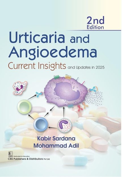 URTICARIA AND ANGIOEDEMA CURRENT INSIGHTS AND UPDATES IN 2025 2ED (Digital Download) • H