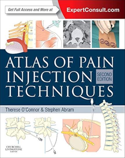 Atlas of Pain Injection Techniques: Expert Consult: Online and Print