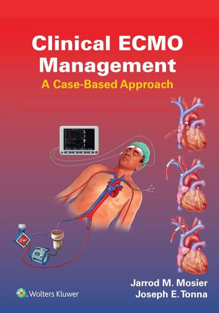 Clinical ECMO Management: A Case-Based Approach