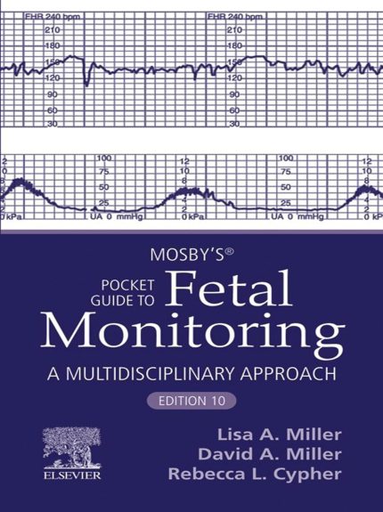 Mosby's® Pocket Guide to Fetal Monitoring - E-Book